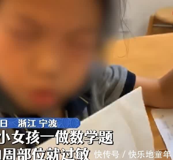 数学|小姑娘一做数学就眼睛过敏,眼睛肿到睁不开