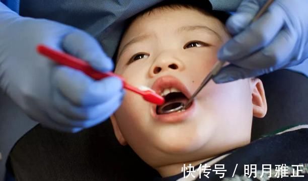 智齿|6岁男娃长“双层牙”,老人的“坏习惯”害了娃,你家有这习惯吗