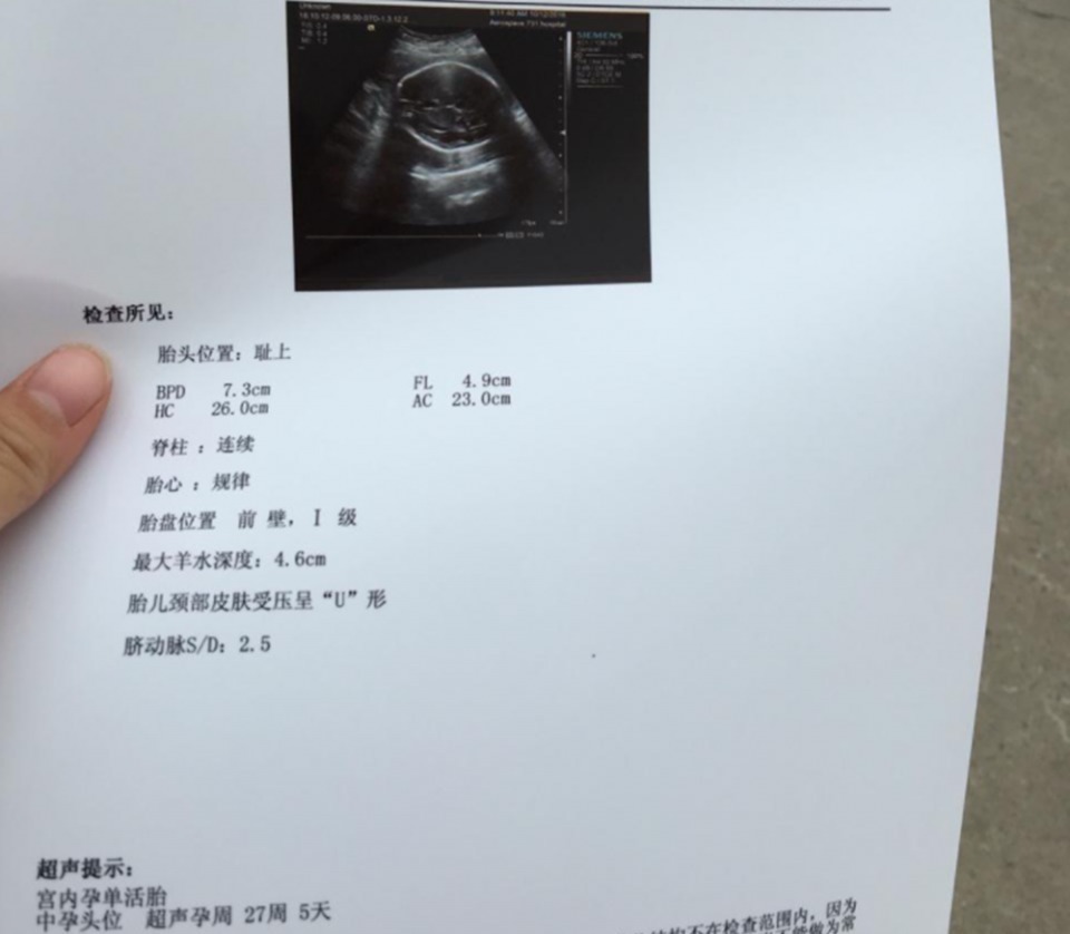 产检|孕28周后产检时,孕妈记得问3个问题,更利于日后的分娩