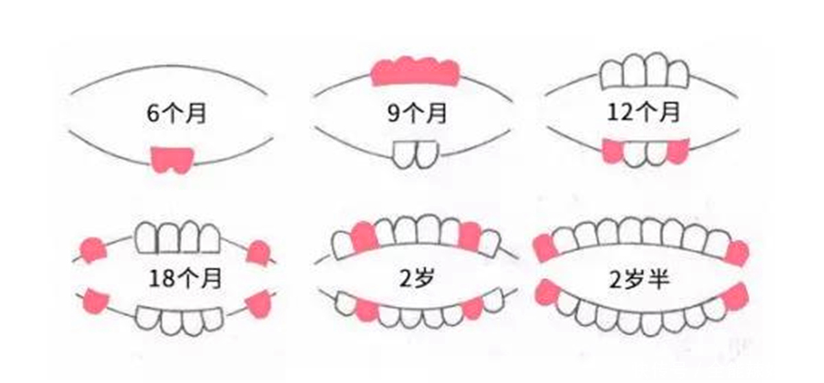 孩子|宝宝准确的出牙时间、顺序是什么? 一张图告诉你，你家娃中了没