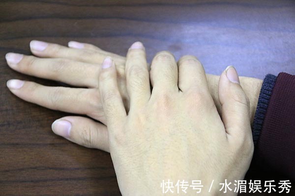 发红|肝硬化先上手脚,手脚的哪些变化,暗示了肝硬化可能找上门了?