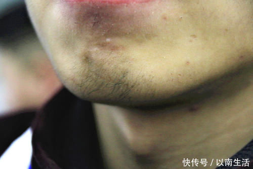 科学|刮胡子次数越多,寿命越长?有科学依据吗?什么时候不宜刮胡子?