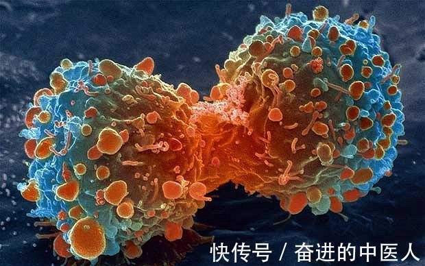 乳腺瘤|成都中医肿瘤研究院万年路2号:乳腺瘤会向哪些部位转移?名老中医这样说