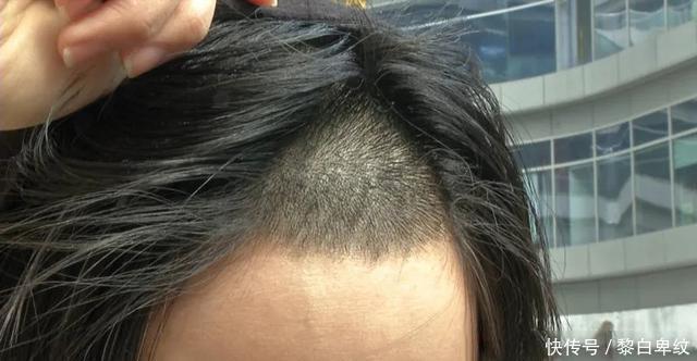 做头发后,发际线高了不止两寸,女子当场蹦了!