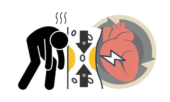 干煸茄子|吃出来的血管病!若想血管年轻健康,避开4种“吸油大户”!