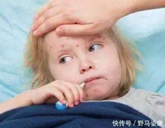 孩子|“白血病”多是拖出来的,孩子一旦有这“3表现”时,家长不要大意了!