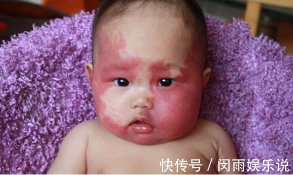 tips|孕期受到三种影响,会让宝宝有“胎记”,可不是碰一下那么简单