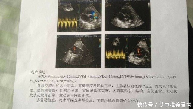 畸形|做四维彩超说胎儿正常，出生后检查出有畸形，医院有责任吗？