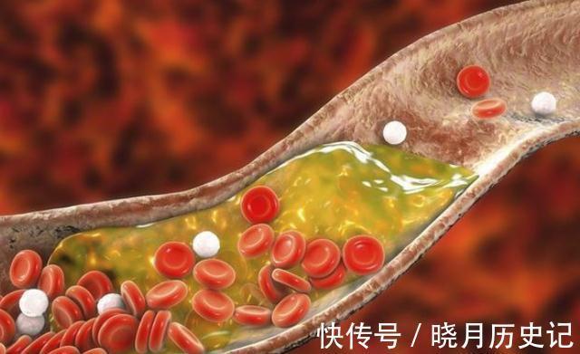 懷孕期間|經常喝黃芪水，人會變得越來越瘦？提醒：這五類人群或不能喝