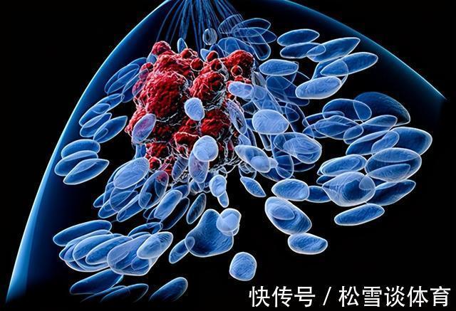 萧何|姚贝娜是名人、条件好，术后却只活了三年多，也许跟3个原因有关