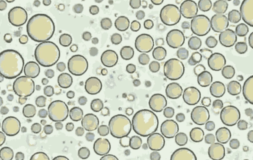 卵巢癌|当母乳被放大1000倍后,在显微镜下轻轻蠕动,纯净得令人难以置信