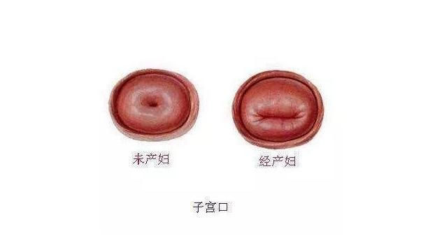 流产史|孕妈顺产4小时生下双胞胎,医生“多嘴”一句话,让丈夫执意离婚