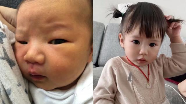 妈妈|“外星人宝宝”火了,刚出生丑哭宝妈,2个月后颜值成功逆袭