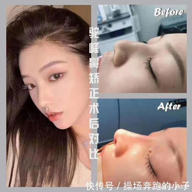 面部一枝花,全靠“鼻”当家