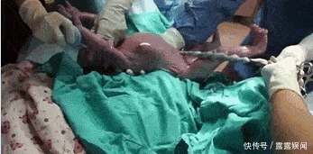 子宫|顺产到底有多疼,给你们看完这18图片,就能真正理解女人不容易