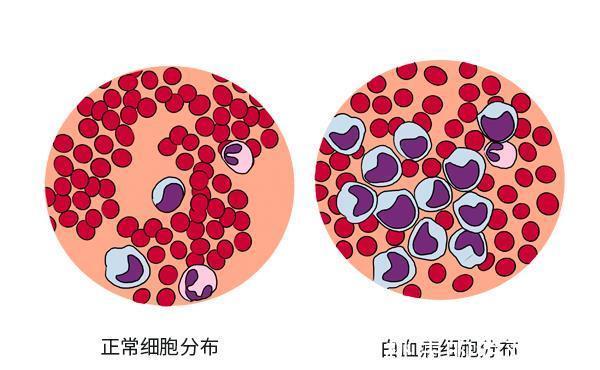 真相|中医治癌的3大误区，很多人深信不疑，真相在这里，切勿轻信