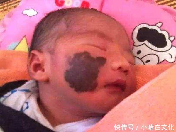 怀孕期间准妈妈这样做,会容易在宝宝身上留下“胎记”