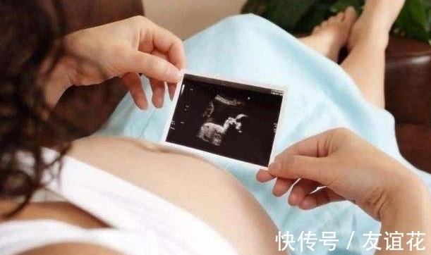 性别|四维彩超上的“信息”可能暗示了宝宝的“性别”,孕妈了解一下