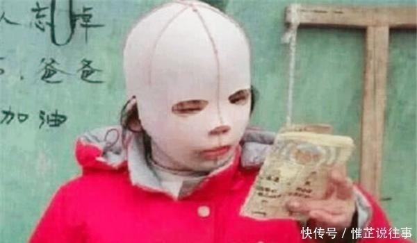 同学|女孩一直戴头套上学,却受尽同学嘲讽,摘下头套后众人都沉默了