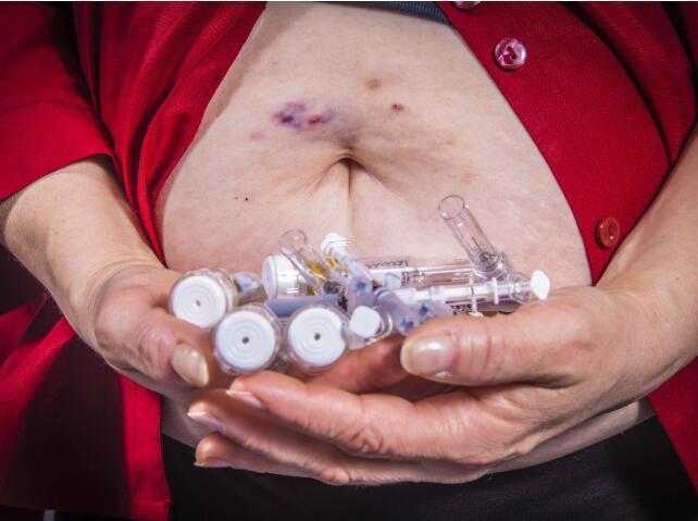 高血糖|体内血糖高,头部先知头部3个异常,暗示糖尿病或已到来!