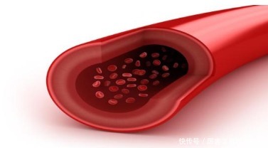 天然的“脑梗药”找到了,家中常备,泡水常喝,血管一天比一天好