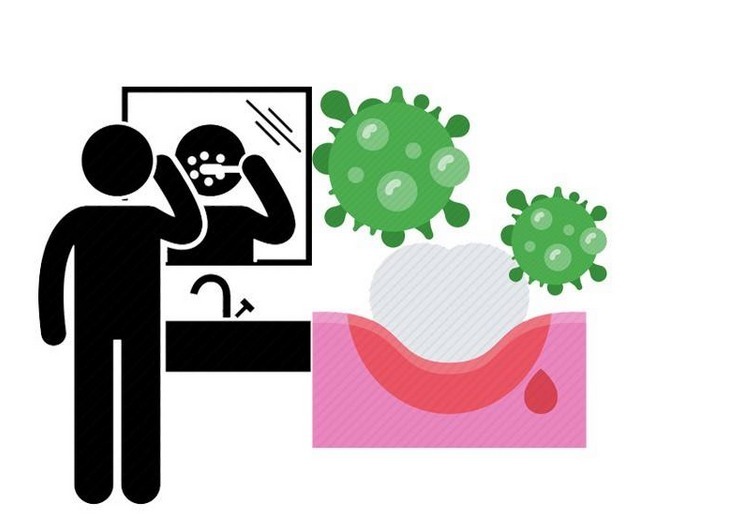 患者|怎么就得了口腔癌?4个习惯劝你尽早改掉,别给癌症留机会