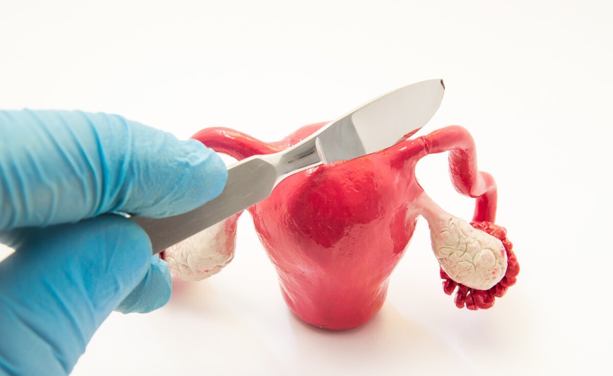 避孕|宫外孕并非都与女性有关,对于丈夫的“怪癖”,妻子不要惯着