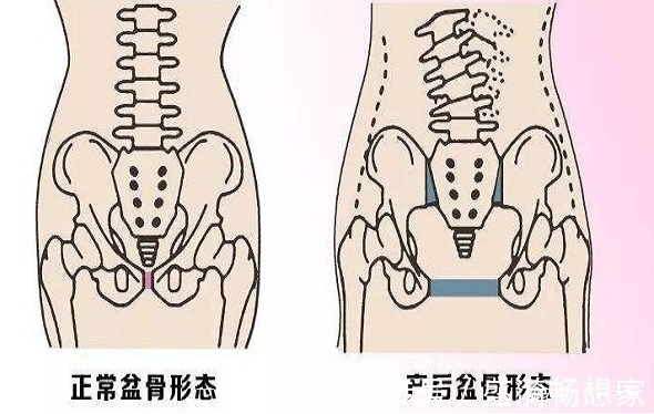 分娩|女性生没生过孩子,身上有4个记号,医生一眼就能看出
