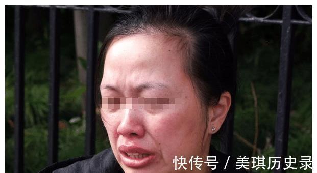 宝妈|3岁男孩长出“鲨鱼牙”,妈妈着急送医检查,医生:无知的父母