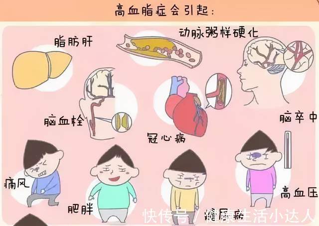 金兰菊根茶|血脂多高才算是高？身体出现5个信号，要开始降脂养血管了