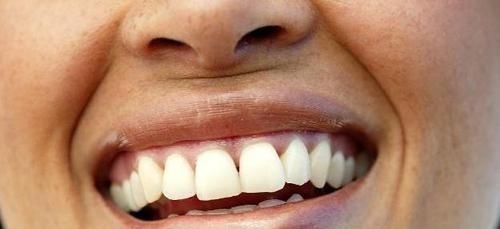 妇科病|女人有没有妇科病，看嘴就能明白，若有表现，十有八九是找上你了