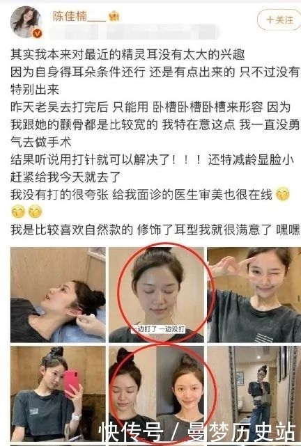 猴相|好奇葩……