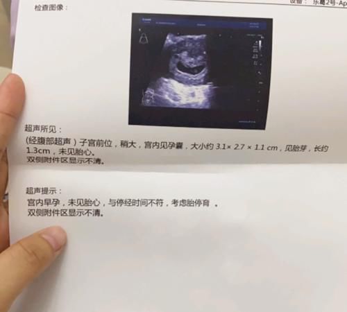 死规矩|怀孕等三个月才能分享好消息?确定三件事,就可以和别人分享喜讯