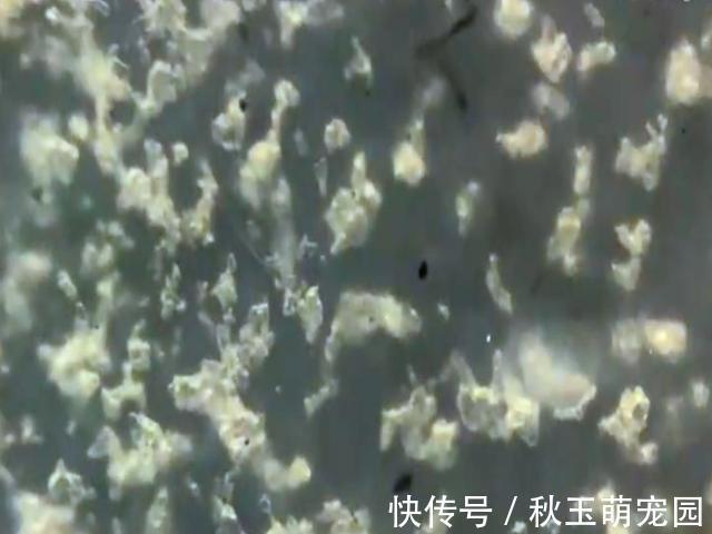 肚子疼!肚脐眼里的“泥”到底是啥?能不能抠?显微镜放大1000倍,真酸爽