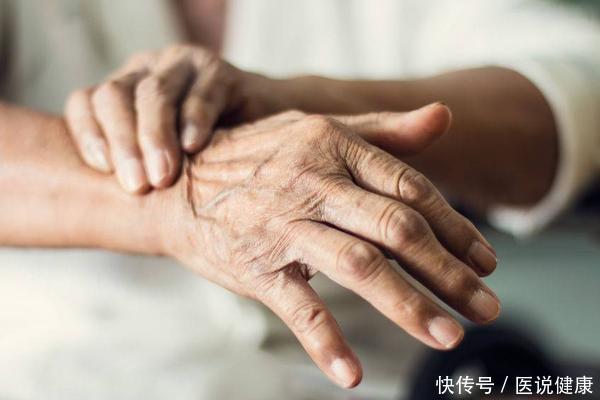 头痛|高血压并非静悄悄!患高血压的人,往往有4个特征,需重视