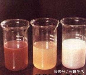 警报器|尿液变色是疾病的警报器！告诉你五颜六色的尿各是什么病