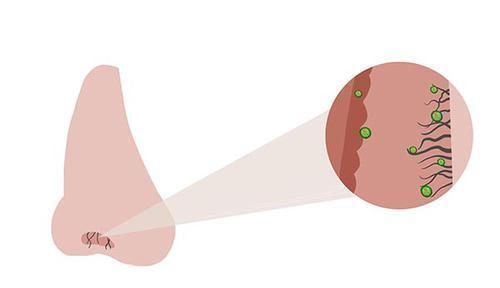 肺部|为何鼻毛总是“冒”出鼻外,说明了什么?能不能直接拔掉?