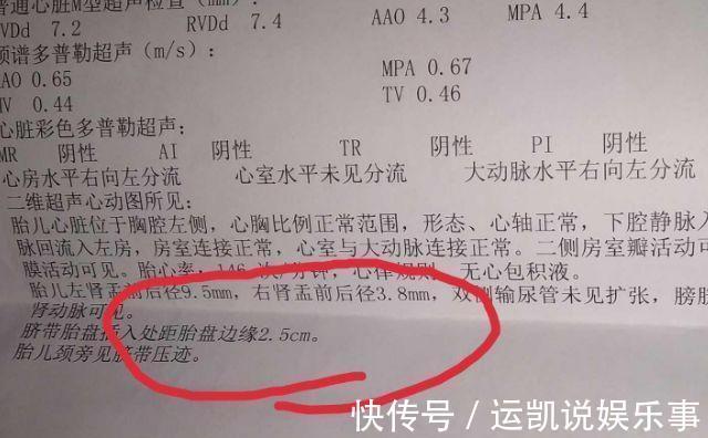 剩余分离|孕检时,B超单上若有4个字,别担心,可能是位“小公子”的暗号