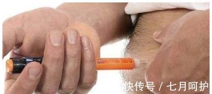 脚部|中年人身体出现这4个症状，说你的糖尿病病情恶化了！小心并发症