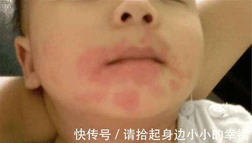 孩子|这“3种水果”吃多了“有害”，尽量少给孩子吃，家长也要管住嘴