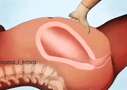 胎盘|生孩子后胎盘是怎样下来的, 看过这组动图你就明白了!