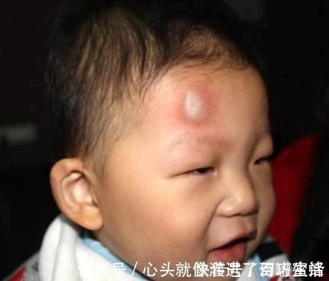 家长|1岁宝宝摔下床,妈妈的做法让奶奶直呼太冷血!医生却说:做得对