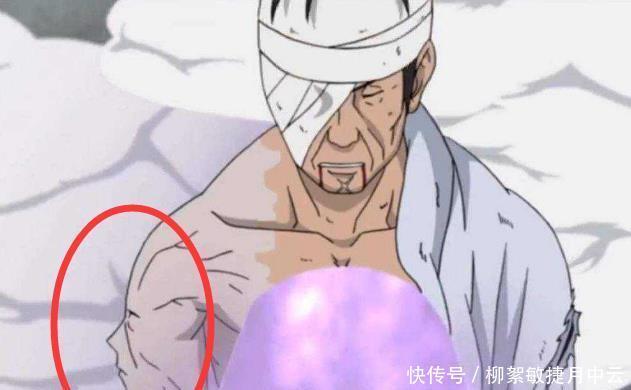 还要|村子的人都知道鸣人用了假肢,为何还要绷带隐藏,鸣人你太年轻!