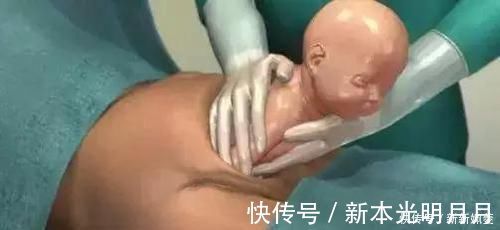 自然分娩|剖腹产到底是怎么“剖”的一组图看清全过程,每个妈妈都是超人