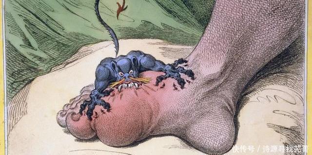 茼蒿|我们的祖先如何对抗痛风有3种神奇植物,还有1种常见野草!