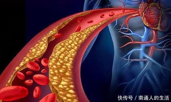 荞麦茶|高甘油三酯的人多吃血管“清洁剂”,降低血脂,预防血栓形成!