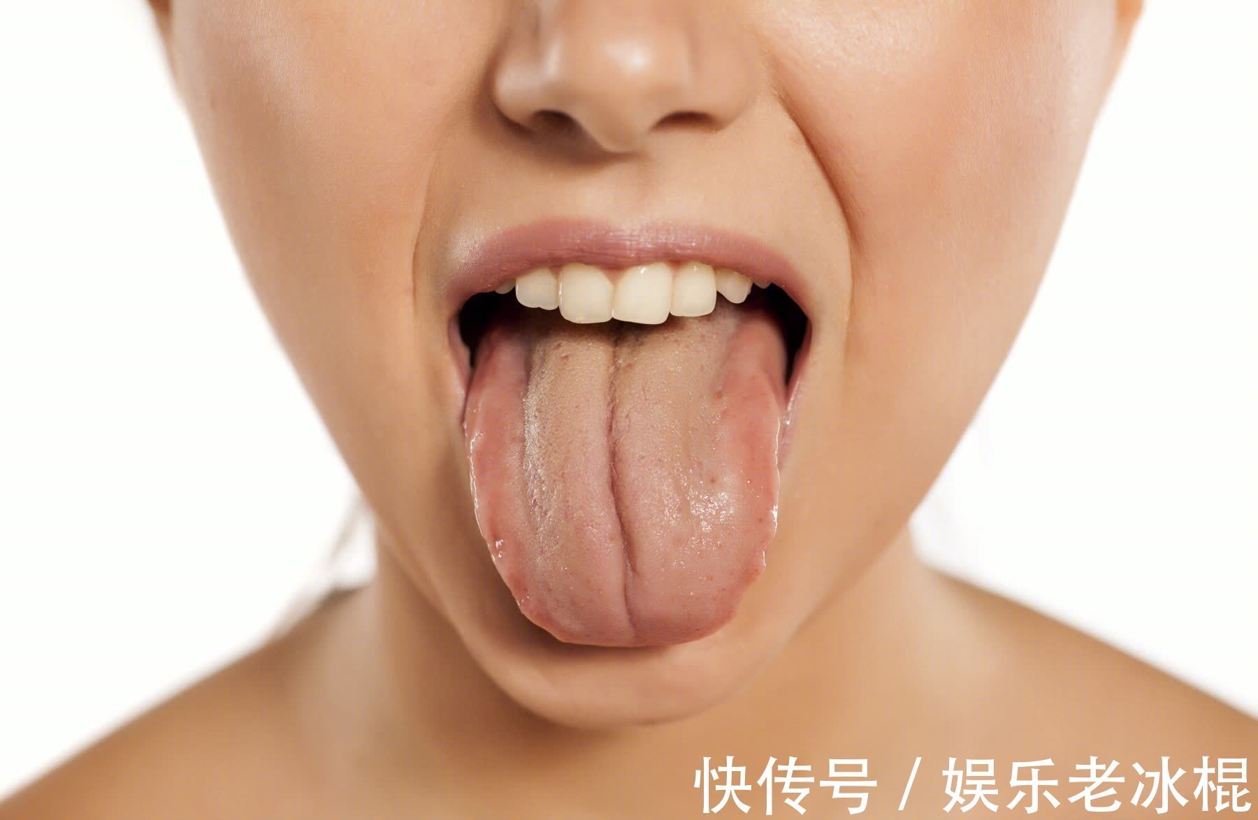 舌象|舌頭一旦出現以下信號，可能是腫瘤！建議馬上去醫院