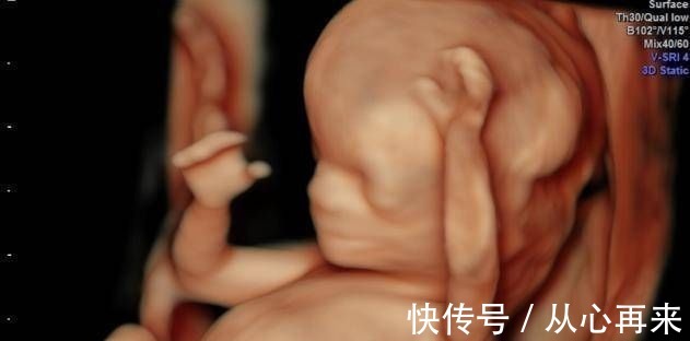 小茹|为什么有些医院做四维彩超不让家属陪同这些原因,大家有权知道