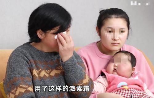 大v|“大头娃娃”再次出现,额头长满汗毛,这次是“毒护肤霜”惹的祸