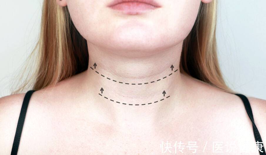 脖子 脖子易“暴露”你的年龄,不想颈部皮肤粗糙皱纹多,做好这4点